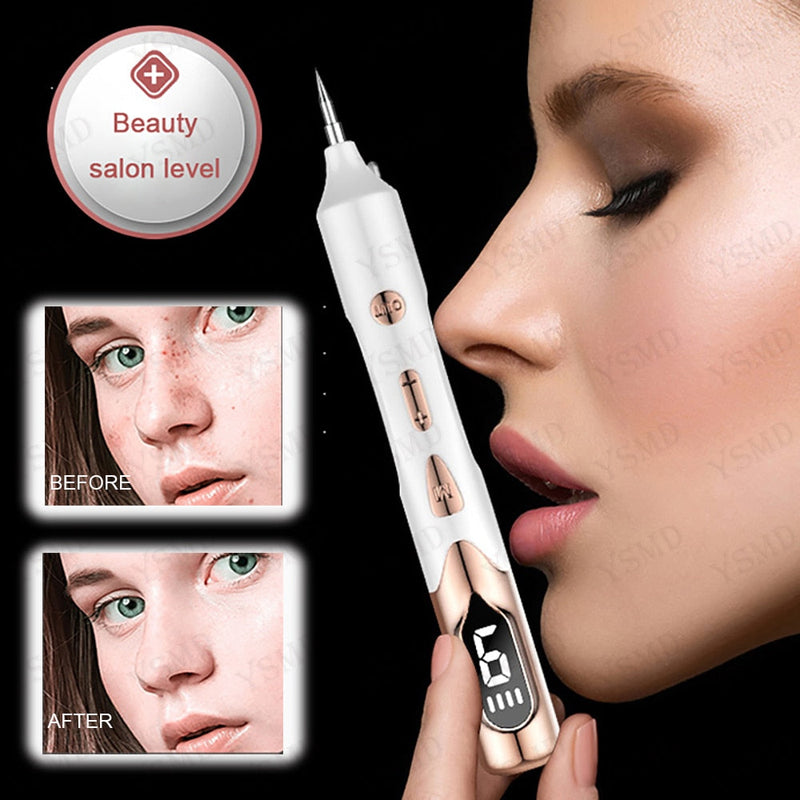 Caneta Plasma Laser - Removedor de Manchas e Verrugas